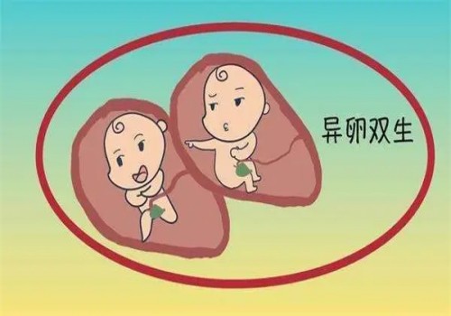 无创DNA能筛查雷特吗？无创DNA主要帮忙解决一些通常解决不了的问题